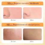 BIOAOUA Rice Pulp Whitening and Repairing Freeze-Dried Powder Set 50mg x 6 blister packs + 3ml x 6 blister packs - Image 5