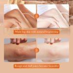 SADOER Joint Whitening and Dark Spot Removal Cream 140g - Image 3