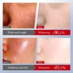 SADOER Kojic Acid Whitening and Spot-Removing 6-Piece Set 120ml + 100ml + 40ml + 50g + 20g + 100g - Image 4
