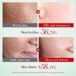 SADOER Niacinamide Whitening Brightening Skincare Set  100g+130ml+100ml+40ml+20g+50g - Image 8