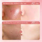 SADOER Peach Probiotic Nourishing and Soothing Lotion 100ml - Image 5