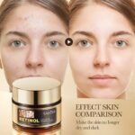 SADOER Retinol Anti-Aging Tightening Five-Piece Set (New Edition) 100g+50g+100ml+100ml+30ml - Image 13