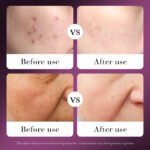 SADOER Snail Recombinant Collagen Emulsion 120ml - Image 3